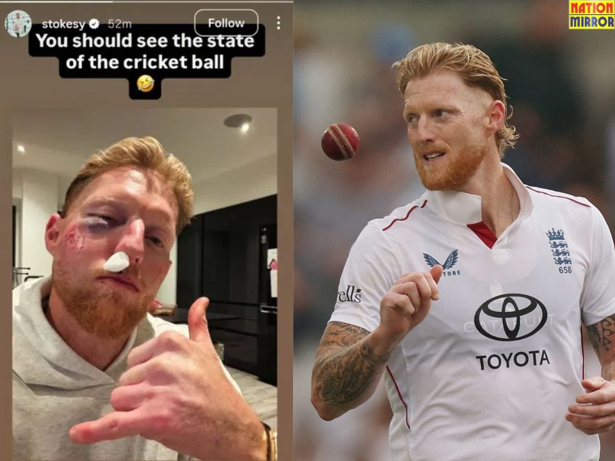 Ben Stokes Face Injury: बेन स्टोक्स हुए भायनक हादसे का शिकार, चेहरे पर आई गंभीर चोटें!
