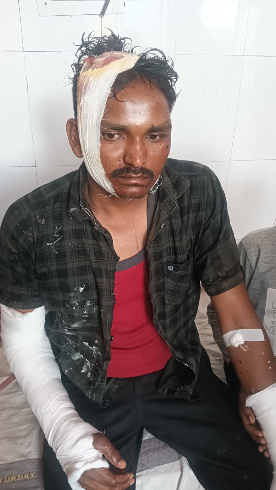 Beohari incident: रिश्तेदार ने युवक पर रॉड से किया जानलेवा हमला, गंभीर हालत में अस्पताल में भर्ती