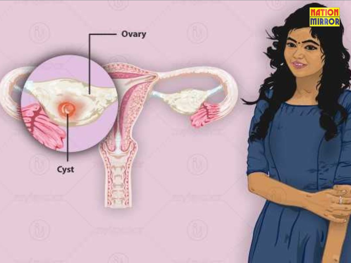 Ovarian Cyst Treatment: महिलाओं में बढ़ रही है ओवेरियन सिस्ट की समस्या, जानें लक्षण, कारण और इलाज...