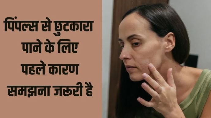 Skin Care: चेहरे पर पिंपल्स कहीं आपकी सेहत का छुपा हुआ दर्द तो नहीं बता रहे?