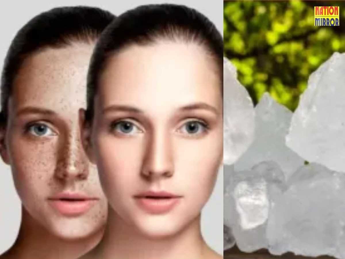 Wrinkle Removal Home Remedy: साबुन की जगह इस चीज से धोएं चेहरा, मिलेगा बेदाग निखार...