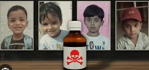 coughsyrup deaths: जहरीले सिरप से 23 मासूम की मौत..सिविल सर्जन को हटाया