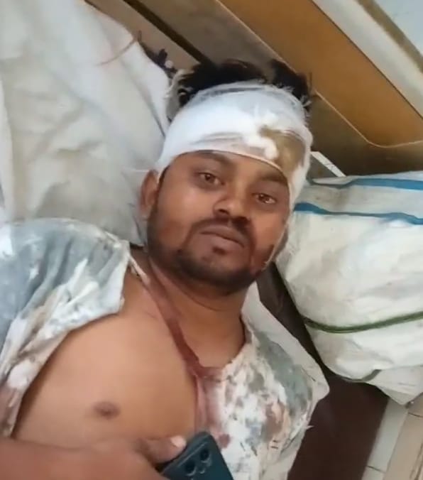 सुल्तानपुर में दलित भाइयों पर जानलेवा हमला लाठी-सरिया से पीटकर लहूलुहान 135 लाख रुपये की नगदी भी लूटी