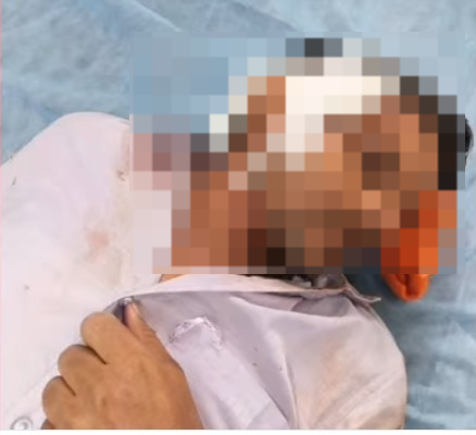 इटावा में दबंगों का कहर पुरानी रंजिश में फावड़े से हमला कर युवक को किया गंभीर घायल