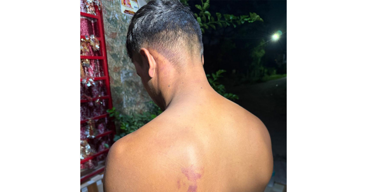 IPL star Shashank Singh, father booked allegedly for assaulting family cook in Bhopal