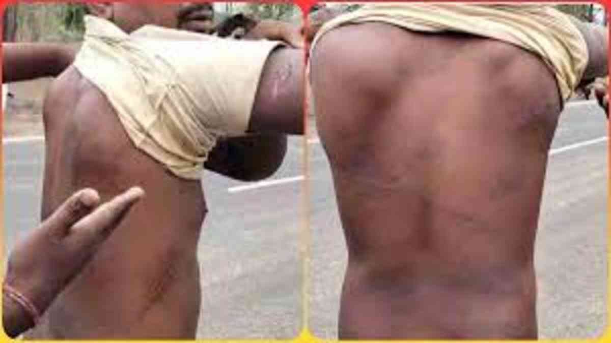 tribal youth assault chhindwara mp एमपी के छिंदवाड़ा में आदिवासी युवक के साथ दरिंदगी पेशाब पिलाई और बेरहमी से पीटा