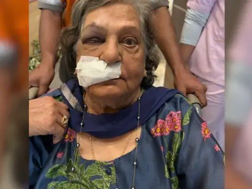 air india  एयर इंडिया ने व्हीलचेयर देने से किया इनकार गिरने से गंभीर घायल हुई