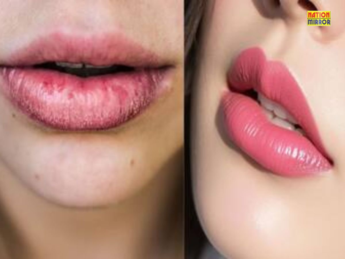 dry lips in summer tips गर्मी में होंठ हो रहे हैं रूखे अपनाएं ये आसान टिप्स पाएं गुलाबी होंठ