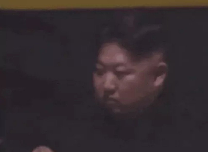 kim jong un health problems  किम जोंग उन को मोटापे के कारण डायबिटीज-ब्लड प्रेशर