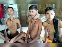family rare disease रीवा में रहस्यमयी बीमारी से जूझ रहा परिवार