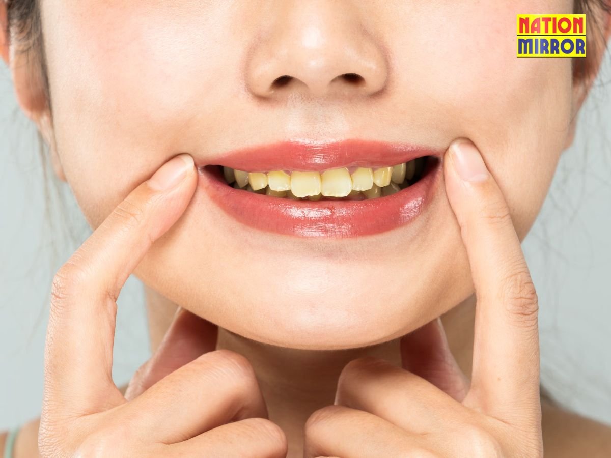 reasons treatment yellow teeth जानिए दांतों में पीलेपन का कारण और निवारण