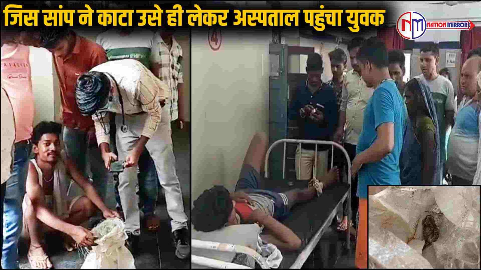 top news 2024 जिस सांप ने काटा उसे ही लेकर अस्पताल पहुंचा युवक