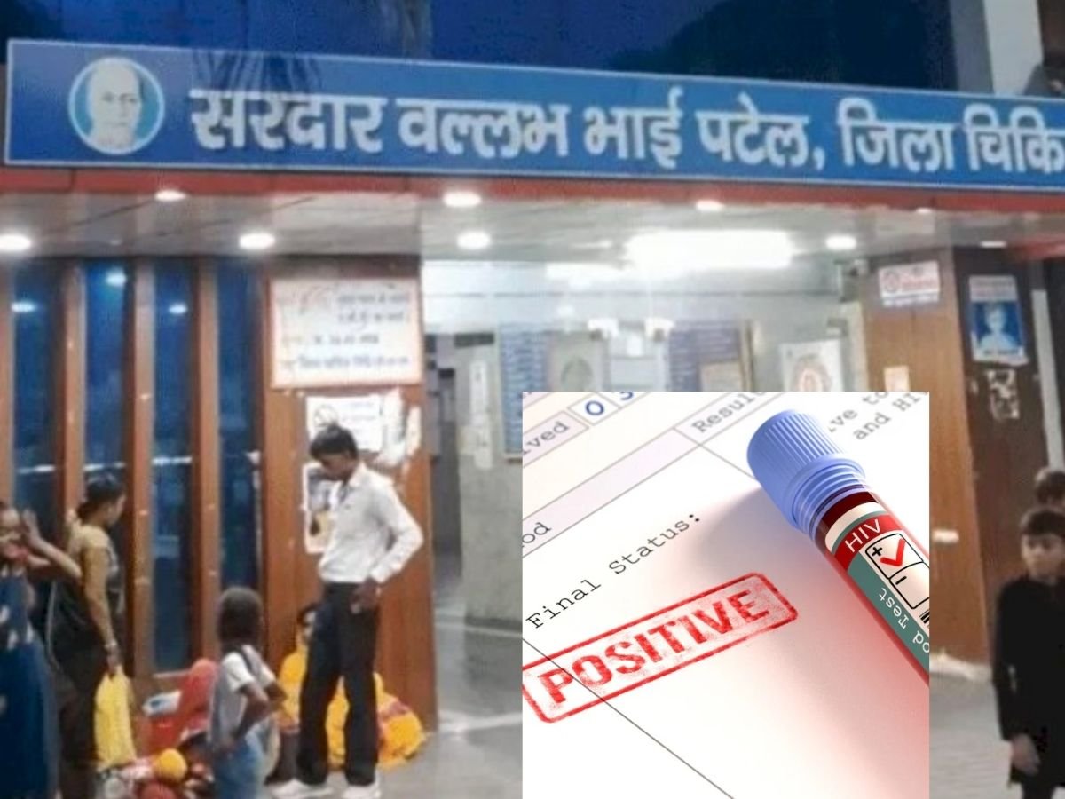 सतना के अस्पताल में 4 बच्चों को चढ़ाया hiv ब्लड 4 महीने बाद हुआ खुलासा