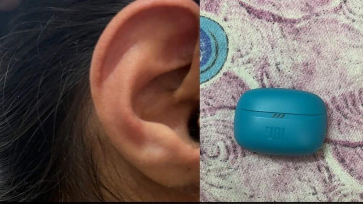 rajasthan student alleges jbl earbud burst inside her ear leading to eardrum’s inflammation shares pics online