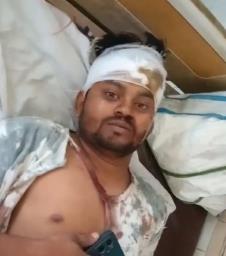 सुल्तानपुर में दलित भाइयों पर जानलेवा हमला, लाठी-सरिया से पीटकर लहूलुहान, 1.35 लाख रुपये की नगदी भी लूटी