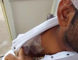 ग्रेटर नोएडा: ढाबे पर काम कर रहे दो कर्मचारियों में विवाद, लोहे के पंच से हमला कर एक घायल