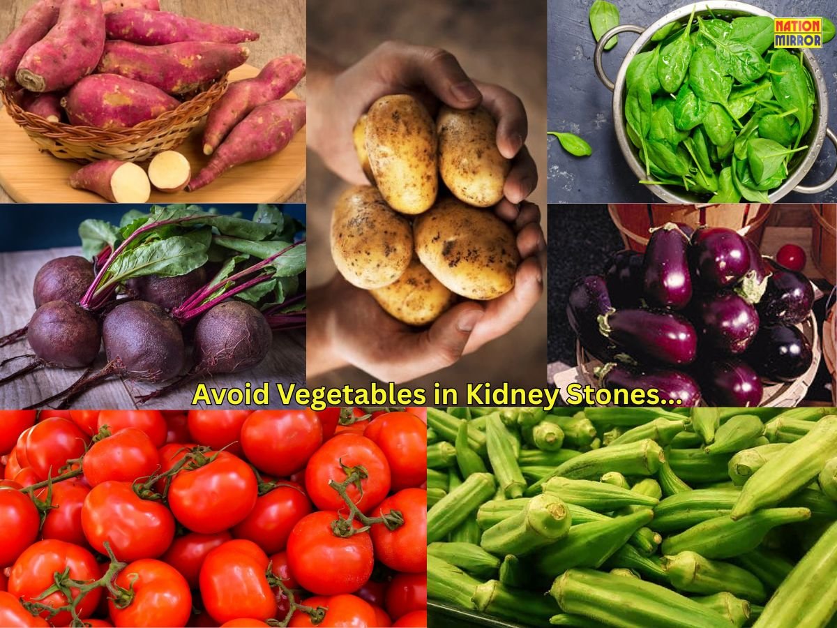 Avoid Vegetables in Kidney Stones: पथरी के मरीज न खाएं ये सब्जियां, वरना बढ़ सकता है दर्द और खतरा!