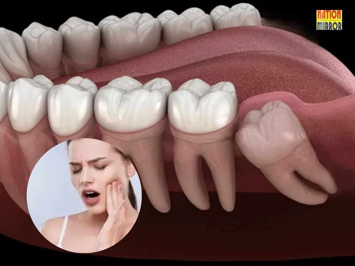 Brain of Wisdom Tooth Connection: कब आती है अक्ल दाढ़? जानिए अक्ल से क्या है कनेक्शन...