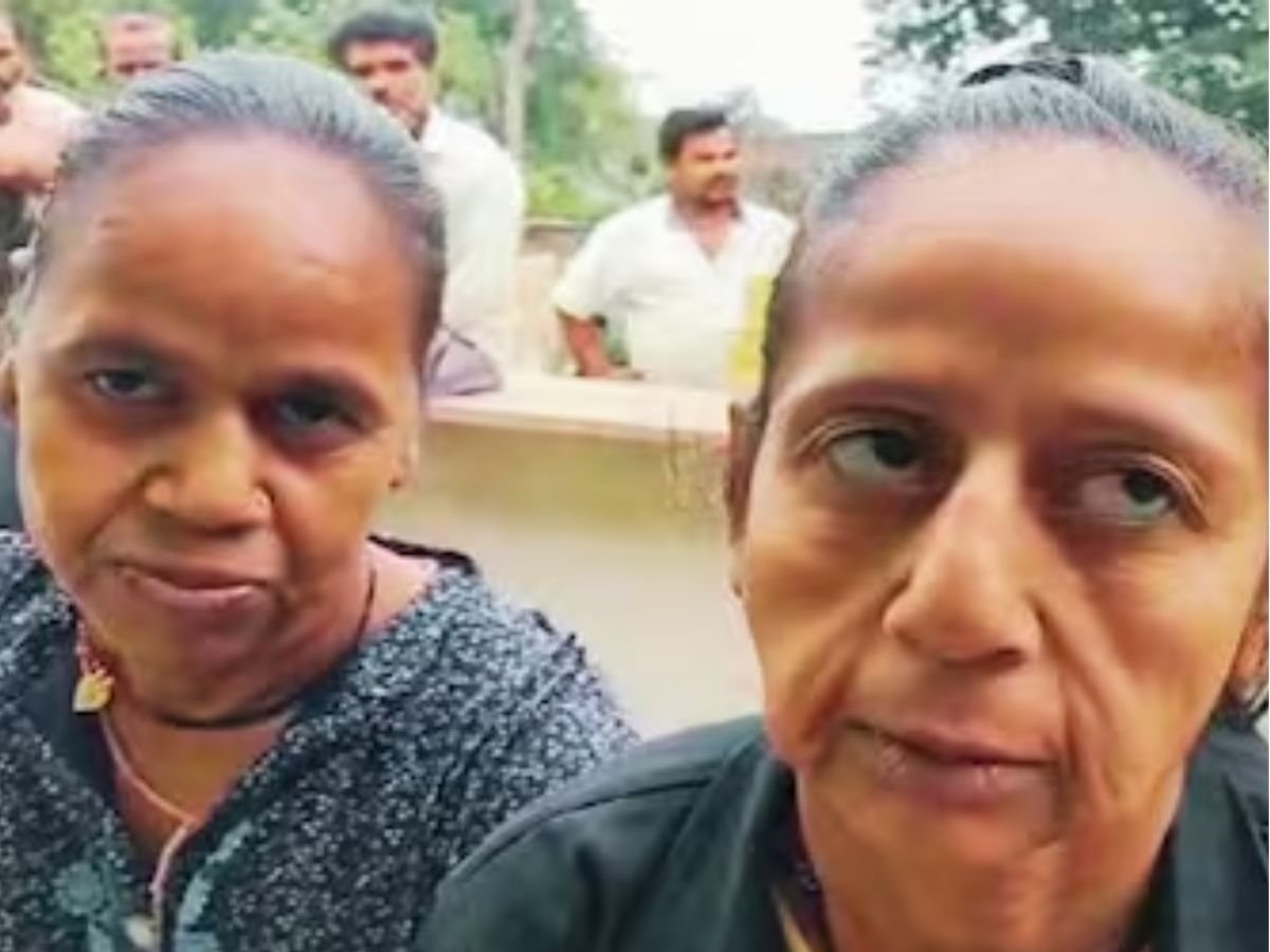 MP NEWS :प्रोजेरिया के मध्य प्रदेश में 4 मरीज मिले,जवानी में आया बुढापा!
