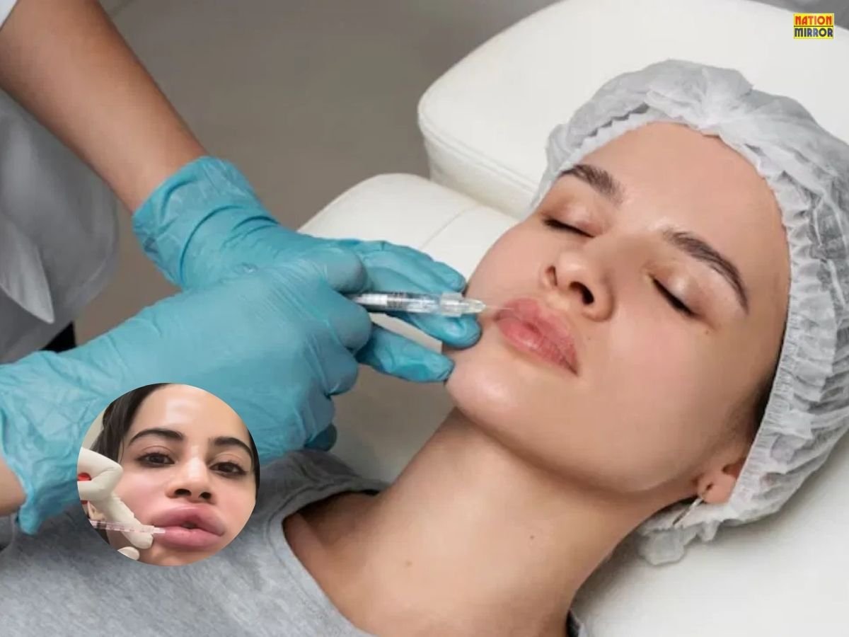 Lip Dissolve Treatment: लिप डिजॉल्व ट्रीटमेंट क्या है? जानिए इसके साइड इफेक्ट्स और जरूरी सावधानियां...