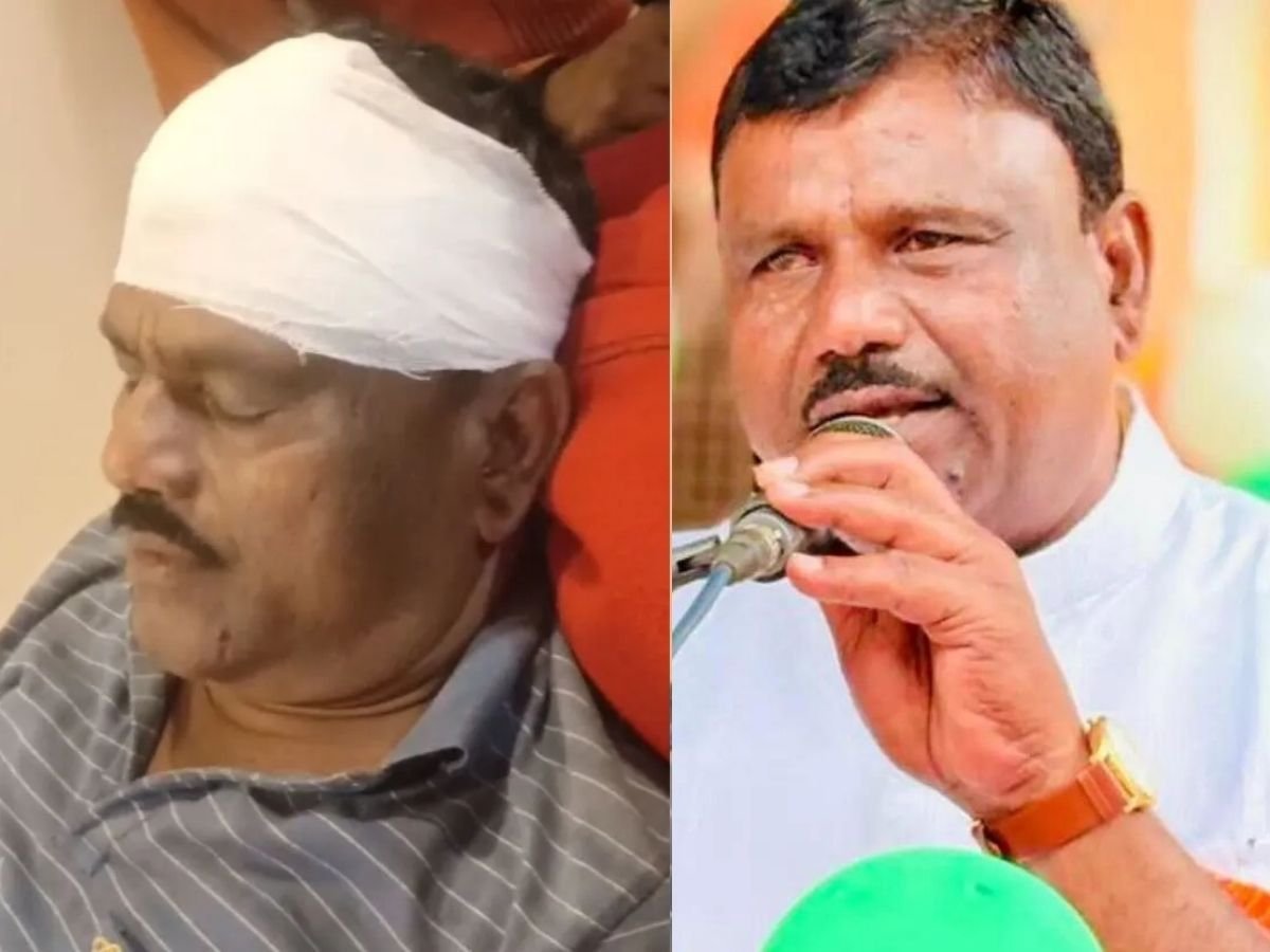 जमीनी विवाद को लेकर BJP विधायक पर हमला, सिर पर लगी गंभीर चोट