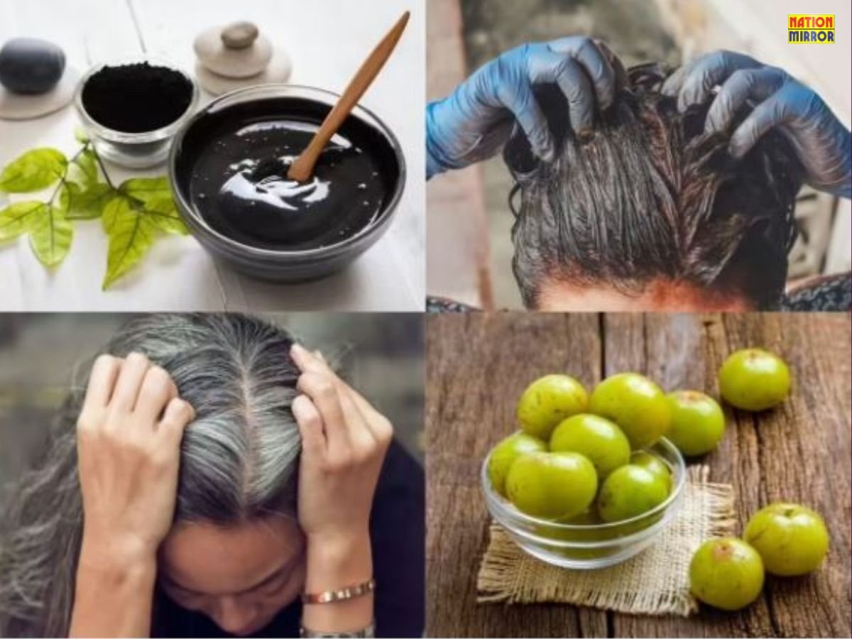 Natural Remedies for White Hair: आसान घरेलू नुस्खे से पाएं काले और चमकदार बाल!