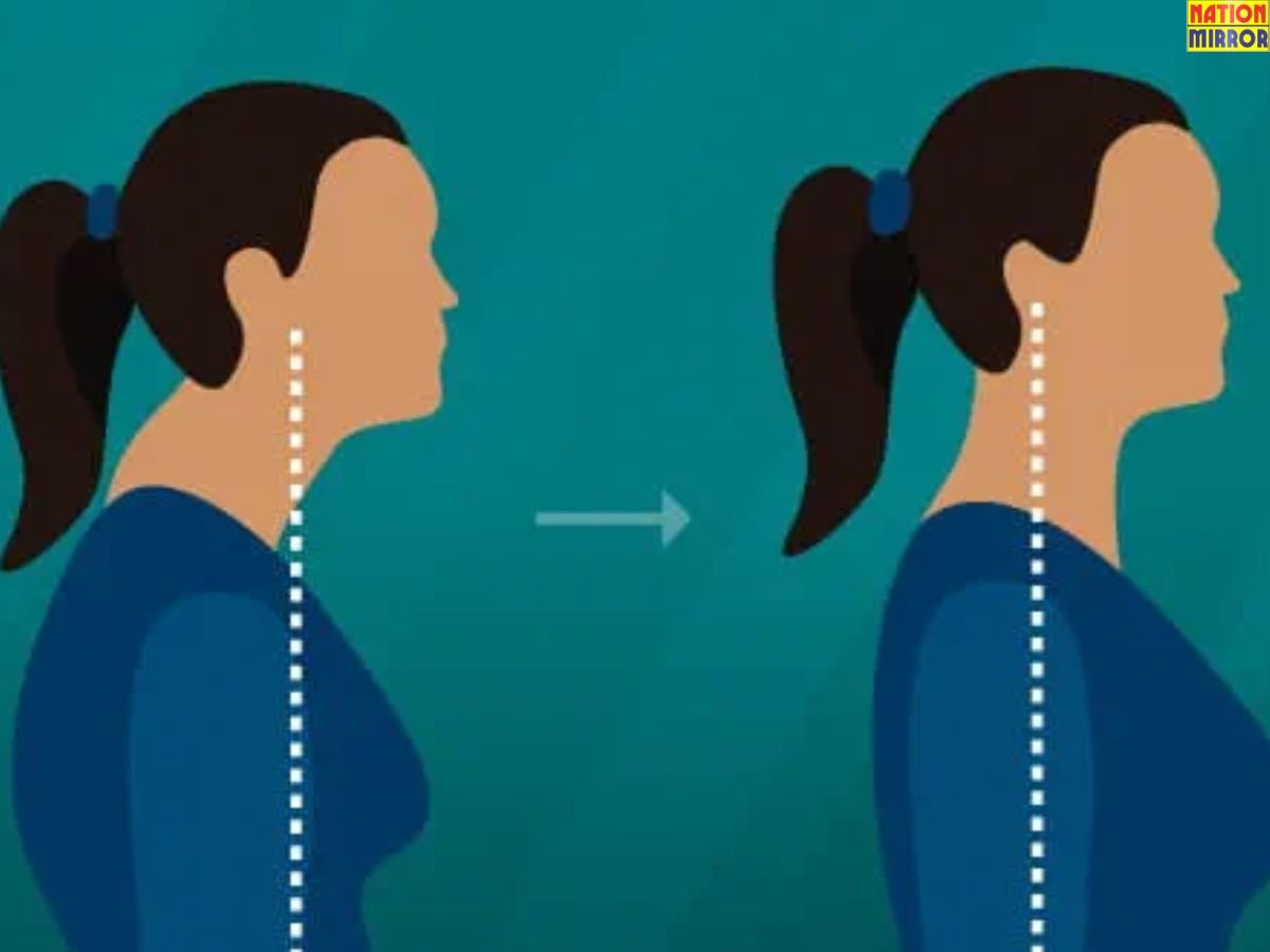 Neck Hump Yoga Exercises: Neck Hump क्या है? इससे छुटकारा पाने के लिए करें ये योगासन...