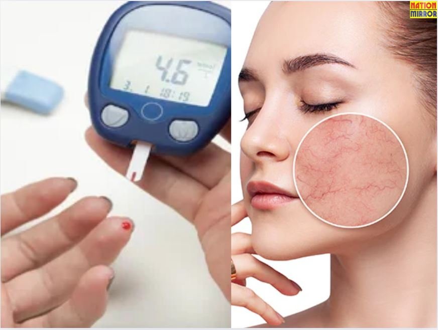 Tips for Health: डायबिटीज से लेकर त्वचा को स्वस्थ रखने तक, ये एक छोटा सा दाना होगा फायदेमंद!