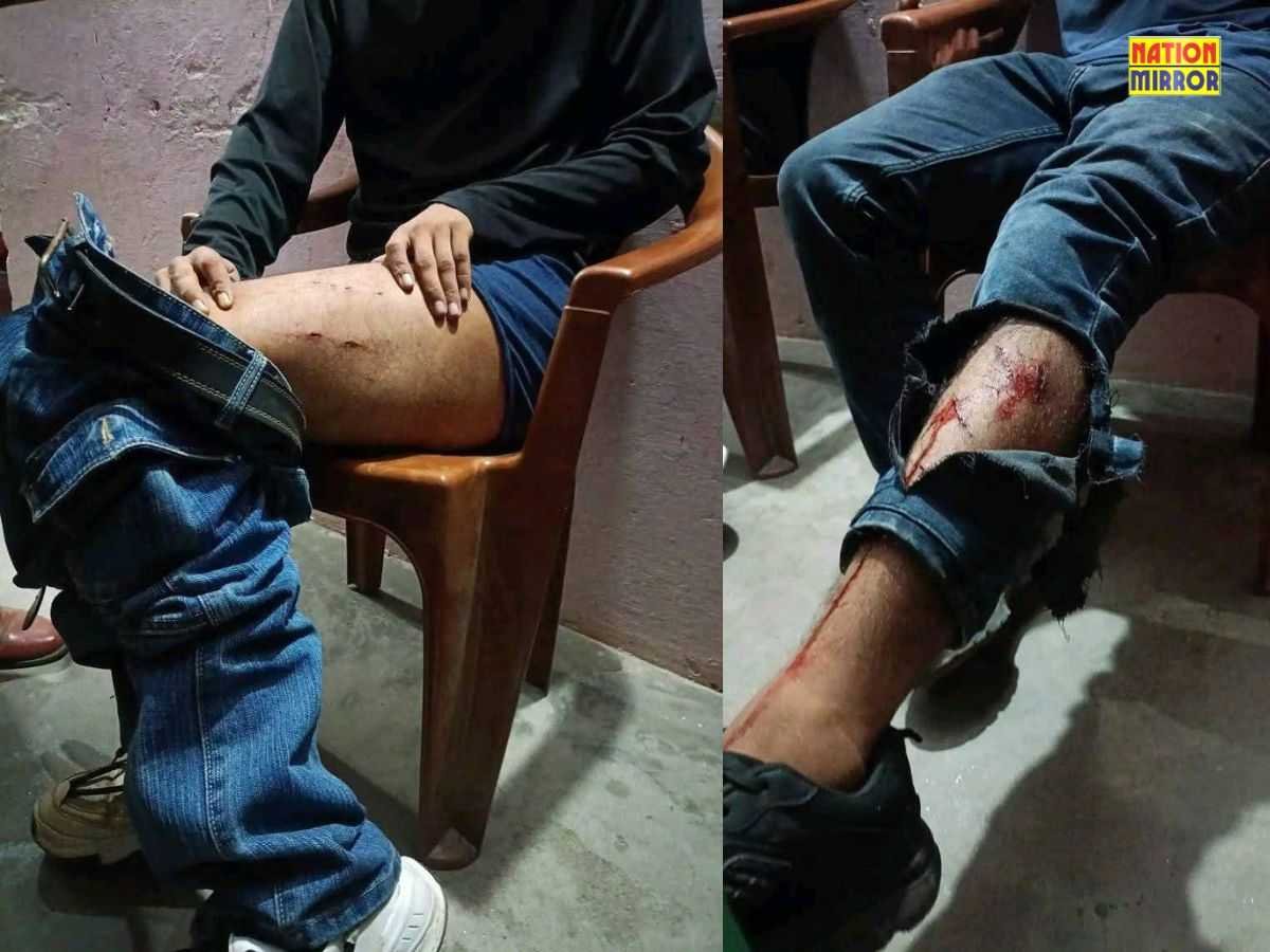 यमुनोत्री राष्ट्रीय राजमार्ग पर गुलदार का हमला: दो युवक घायल, दहशत में लोग